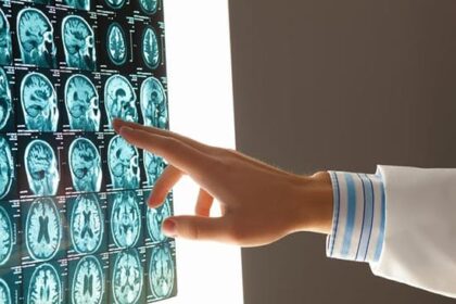 MRI of a brain injury.
